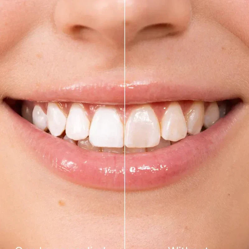 ✨ Pasta za zube za trenutno izbjeljivanje — Rezultati su vidljivi odmah! Pakiranje od 5 ml, dugi rok trajanja! 😁🦷