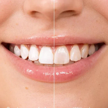 ✨ Pasta za zube za trenutno izbjeljivanje — Rezultati su vidljivi odmah! Pakiranje od 5 ml, dugi rok trajanja! 😁🦷