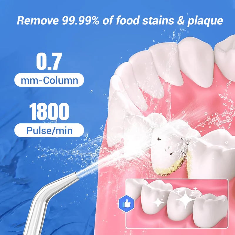 🦷 Prijenosni oralni irigator sa zubnim koncem